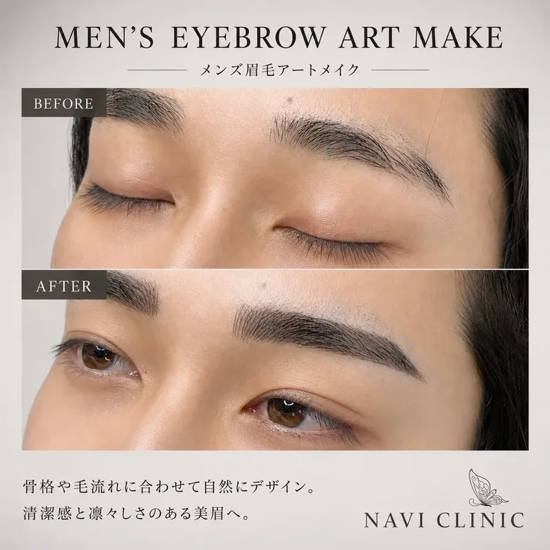 メンズ眉毛アートメイクの症例 Before/After