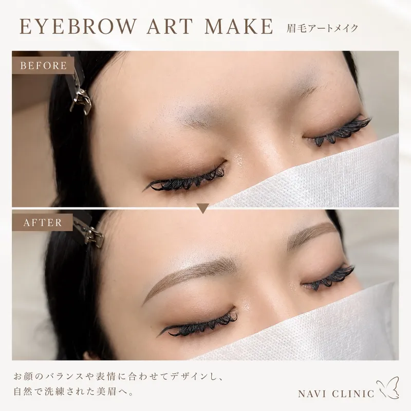 眉毛アートメイク(スタッフ施術)