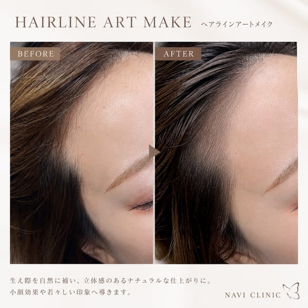 ヘアラインアートメイク